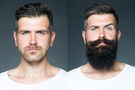 Featured image of post Rogaine Minoxidil Beard Before And After Does rogaine work for beards